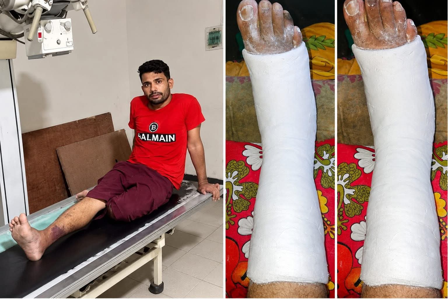 দুই সপ্তাহের চিকিৎসার পরও পুরোপুরি সুস্থ নয় ডান পা, নতুন করে তিন সপ্তাহের প্লাস্টার সকলের কাছেই দোয়া চাই
